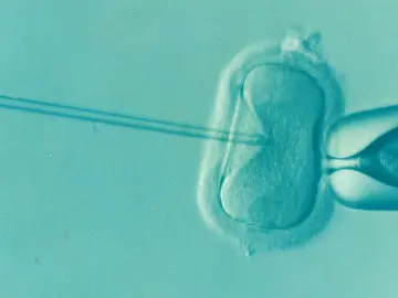 Fecundación in vitro Fecundación in vitro
