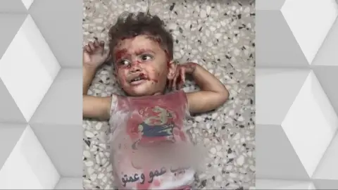 Un niño, tras un ataque a Gaza Un niño, tras un ataque a Gaza