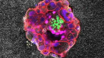 Embrión humano de nueve días Embrión humano de nueve días