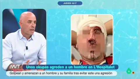 Medina, sobre los okupas que han agredido a un hombre en L'Hospitalet: "Se podrían enfrentar a penas de 2 a 4 años" Como expone el abogado, la gravedad de las lesiones provocadas por estos okupas podrían implicar penas de prisión. Estos okupas, además, también han amenazado a la familia del agredido.