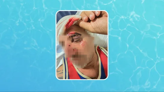 Un hombre agredido por unos okupas en L' Hospitalet Un hombre agredido por unos okupas en L' Hospitalet