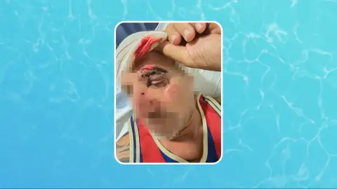 Un hombre agredido por unos okupas en L' Hospitalet Un hombre agredido por unos okupas en L' Hospitalet