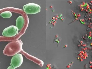 Bacterias implicadas en este tipo de tumores Bacterias implicadas en este tipo de tumores