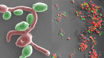 Bacterias implicadas en este tipo de tumores