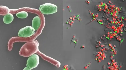 Bacterias implicadas en este tipo de tumores Bacterias implicadas en este tipo de tumores