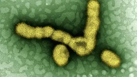 El estudio revela alteraciones en la microbiota pulmonar ocasionadas por la infección El estudio revela alteraciones en la microbiota pulmonar ocasionadas por la infección