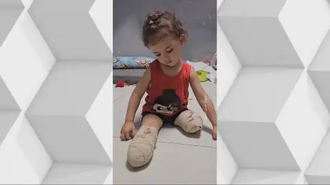 Gaza tiene ya el mayor número de amputados per cápita del mundo Gaza tiene ya el mayor número de amputados per cápita del mundo