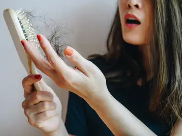 Caída del cabello Caída del cabello