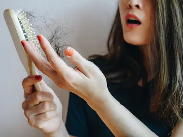 Caída del cabello Caída del cabello