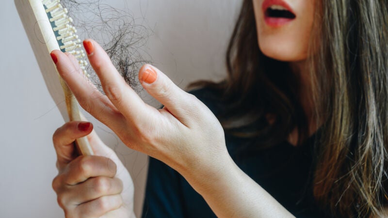 ¿Por qué se nos cae el pelo en otoño?