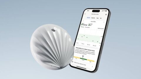 Withings U-Scan Nutrio 