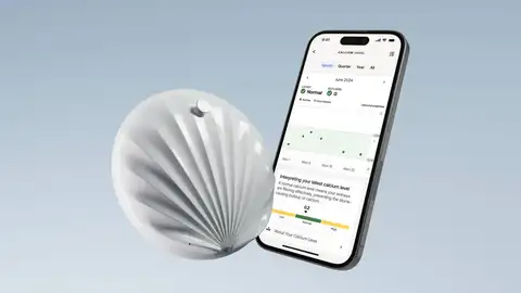Withings U-Scan Nutrio  Withings U-Scan Nutrio