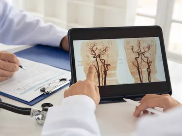 Equipo médico de radiología que busca una radiografía del cerebro para diagnosticar un accidente cerebrovascular isquémico Equipo médico de radiología que busca una radiografía del cerebro para diagnosticar un accidente cerebrovascular isquémico