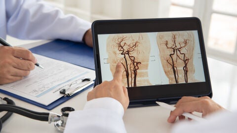 Equipo m&eacute;dico de radiolog&iacute;a que busca una radiograf&iacute;a del cerebro para diagnosticar un accidente cerebrovascular isqu&eacute;mico 