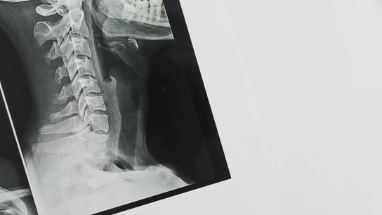 Una radiografia de huesos. Una radiografia de huesos.