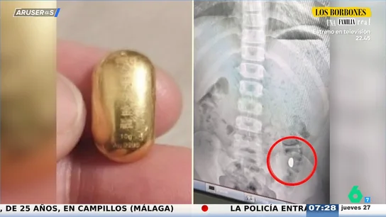 Una madre china encierra a su hijo tras tragarse una pieza de oro de 250.000 euros para no "perderla" Una madre china encierra a su hijo tras tragarse una pieza de oro de 250.000 euros para no "perderla"