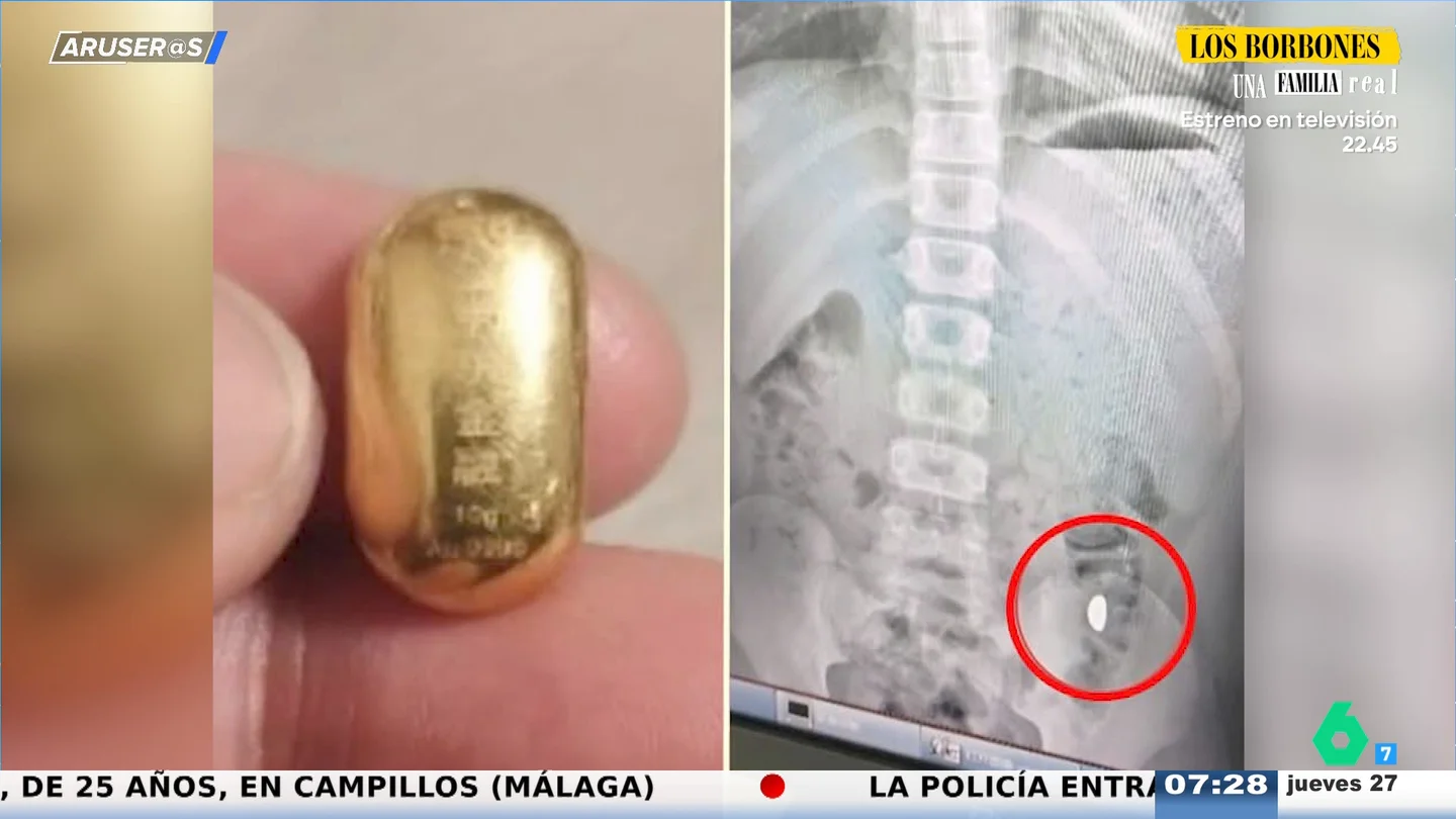 Una madre china encierra a su hijo tras tragarse una pieza de oro de 250.000 euros para no "perderla" Una madre china encierra a su hijo tras tragarse una pieza de oro de 250.000 euros para no "perderla"