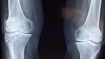 Descubren un interruptor maestro del envejecimiento: activarlo regenera los cartílagos de las articulaciones Descubren un interruptor maestro del envejecimiento: activarlo regenera los cartílagos de las articulaciones