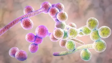 Candida albicans Candida albicans