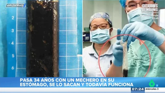 El surrealista vídeo viral de un hombre que vive 34 años con un mechero en el estómago y aún funciona El surrealista vídeo viral de un hombre que vive 34 años con un mechero en el estómago y aún funciona