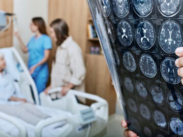 Tratamiento Alzheimer