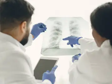 Radiografía de pulmón Radiografía de pulmón