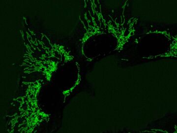 Mitocondrias en c&eacute;lulas humanas sanas