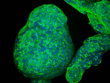 Imagen microscópica de un organoide pancreático con todas sus células Imagen microscópica de un organoide pancreático con todas sus células