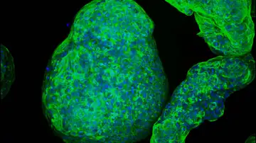 Imagen microscópica de un organoide pancreático con todas sus células Imagen microscópica de un organoide pancreático con todas sus células