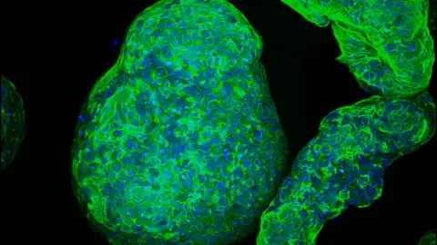 Imagen microscópica de un organoide pancreático con todas sus células Imagen microscópica de un organoide pancreático con todas sus células