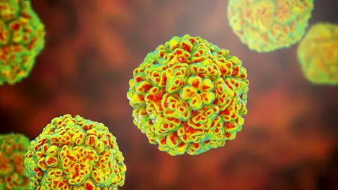 Enterovirus Enterovirus