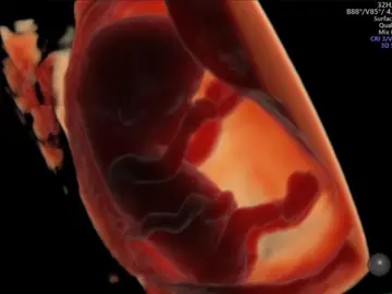 Embrión de unas 11 semanas de gestación Embrión de unas 11 semanas de gestación