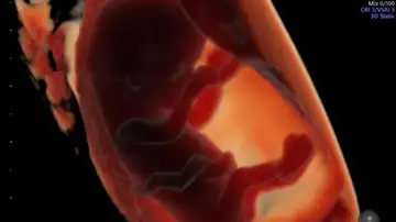 Embrión de unas 11 semanas de gestación Embrión de unas 11 semanas de gestación