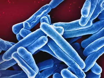 Bacteria Mycobacterium tuberculosis, el patógeno responsable de la enfermedad de la tuberculosis Bacteria Mycobacterium tuberculosis, el patógeno responsable de la enfermedad de la tuberculosis