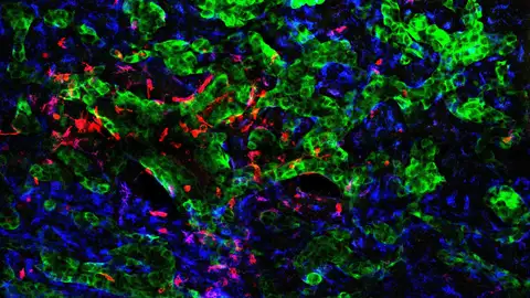 Experimentos del CNIO Experimentos del CNIO