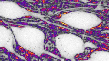 Neuronas en blanco y espacio extracelular en color