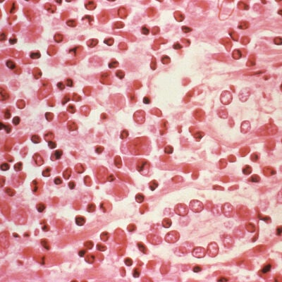 Imagen microsc&oacute;pica del hantavirus