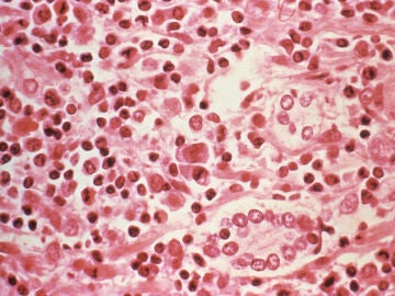 Imagen microsc&oacute;pica del hantavirus