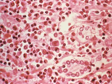 Imagen microscópica del hantavirus Imagen microscópica del hantavirus