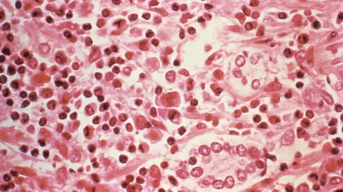 Imagen microscópica del hantavirus Imagen microscópica del hantavirus