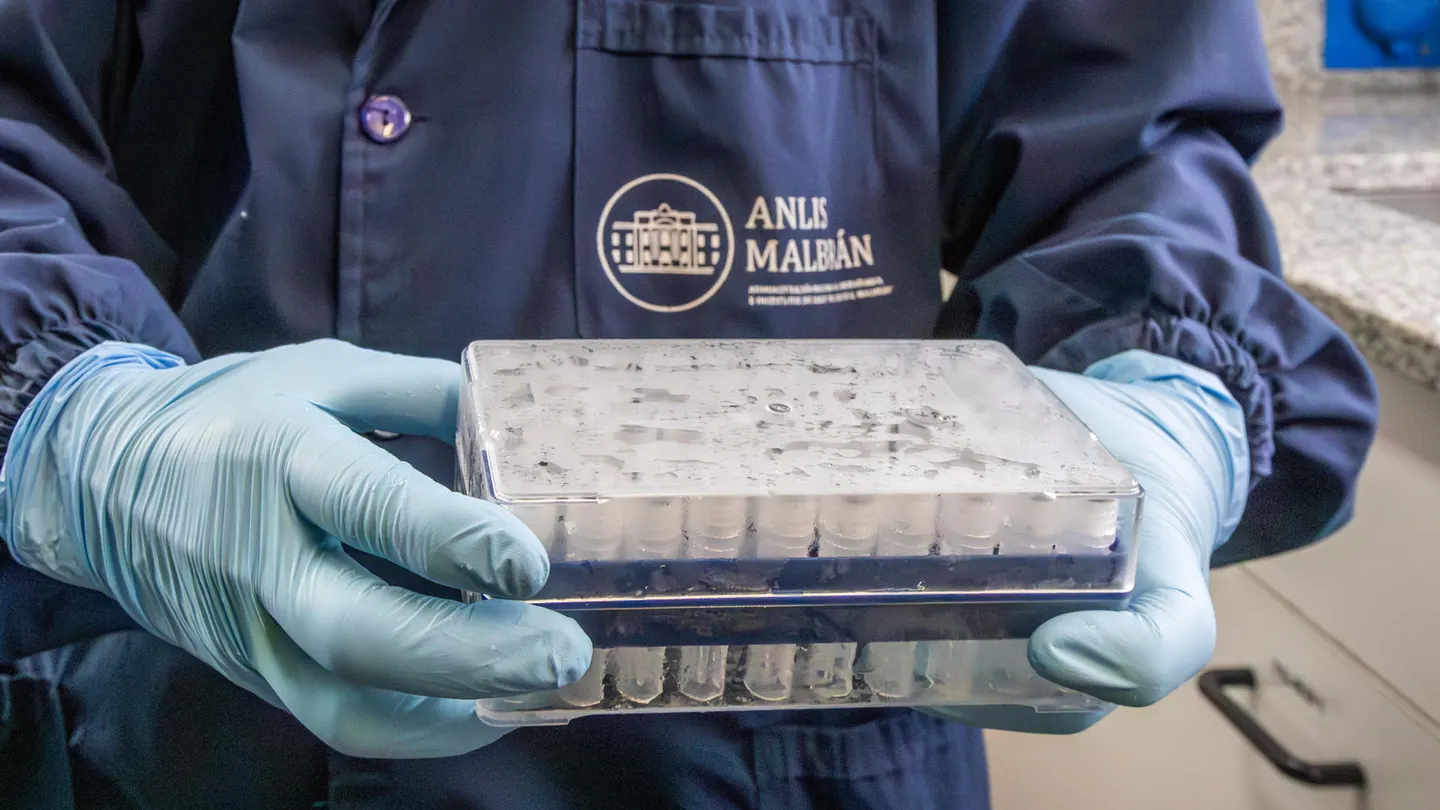 Fotografía cedida por ANLIS Malbrán que muestra a una persona sosteniendo una bandeja con tubos de laboratorio en Buenos Aires Fotografía cedida por ANLIS Malbrán que muestra a una persona sosteniendo una bandeja con tubos de laboratorio en Buenos Aires