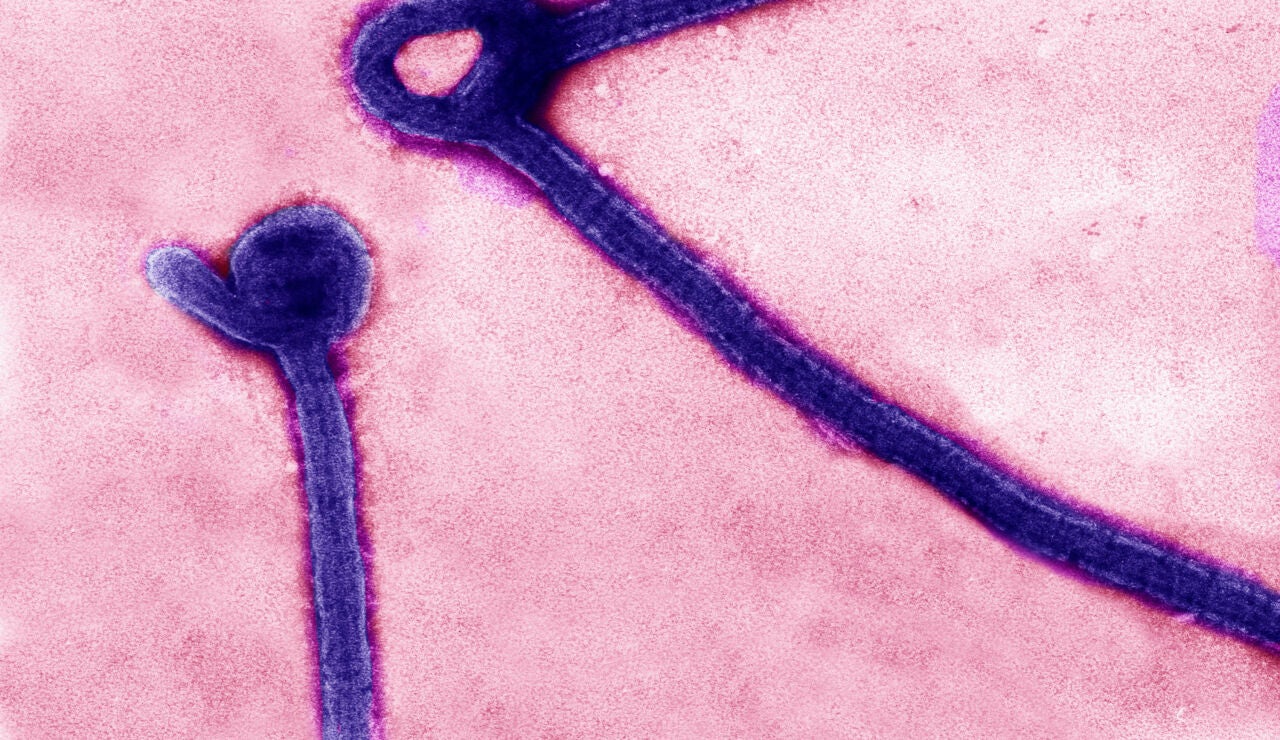 Virus del &eacute;bola en microscopio
