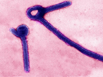 Virus del &eacute;bola en microscopio
