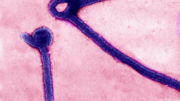 Virus del &eacute;bola en microscopio
