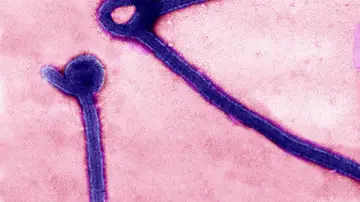 Virus del ébola en microscopio Virus del ébola en microscopio