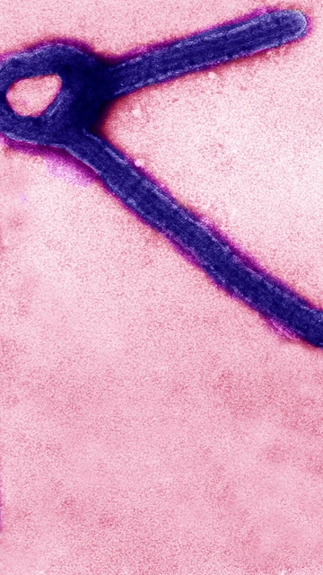 Virus del ébola en microscopio Virus del ébola en microscopio