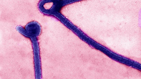 Virus del &eacute;bola en microscopio