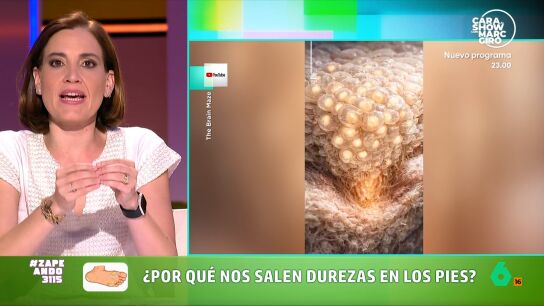La farmac&eacute;utica indica que las durezas son una respuesta de defensa del cuerpo ya que, ante un roce continuado, la piel fabrica m&aacute;s queratina y se engrosa. 