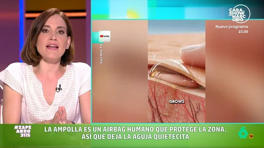 Boticaria García explica por qué no hay que explotar las ampollas: "Se abre la puerta a infecciones" La farmacéutica explica que estas burbujas aparecen debido a la fricción. Las capas superficiales de la piel se separan y, además, entre ellas se acumula líquido.