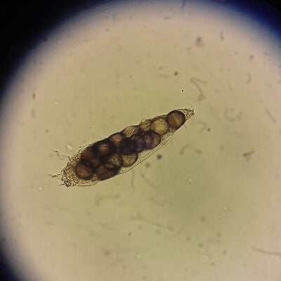Demodex folliculorum
